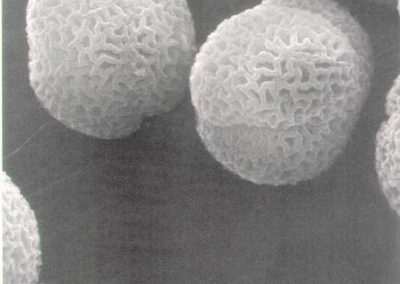 Pollen of Olea **, Electronic microscope pollen view