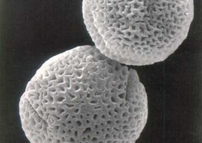 Vista del polen de Fraximus al microscopio electrónico**