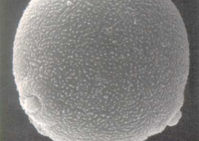 Vista del polen al microscopio electrónico**