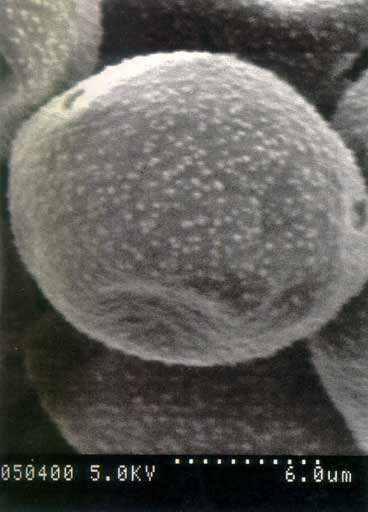 Electronic microscope pollen view**