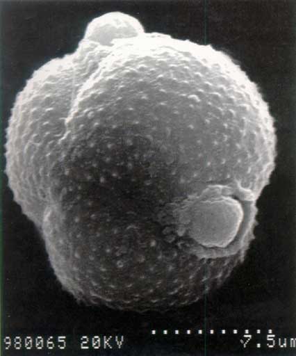Electronic microscope pollen of Artemisia view **