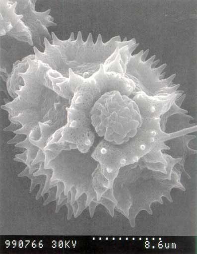 Vista del polen de Taraxacum al microscopio electrónico **