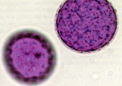 Optical microscope pollen view**