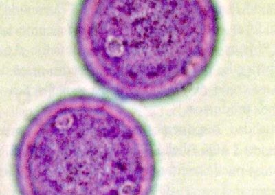 Vista del polen al microscopio óptico**