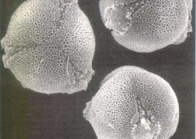 Electronic microscope pollen view**